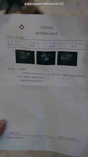  (พากย์ไทย)โลกนี้ไม่มีสิ่งใดเทียบเท่าคุณ