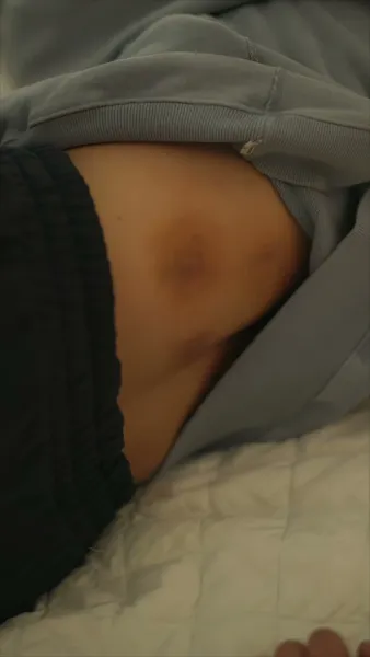 ไฟท์รัก ซัมเมอร์