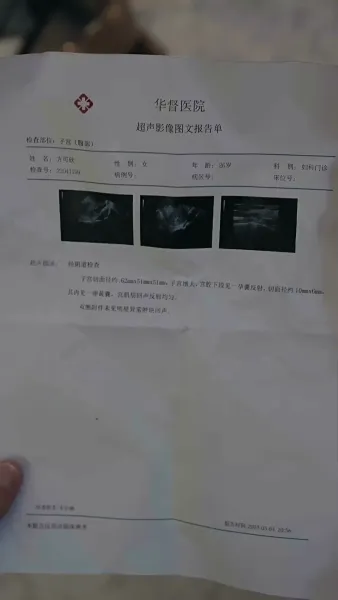 โลกนี้ไม่มีสิ่งใดเทียบเท่าคุณ