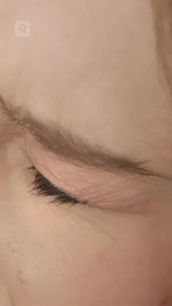 ตัวแทนอุบัติเหตุสำหรับอัลฟ่า