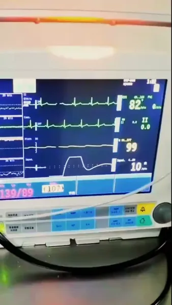  เมียสองบุคลิกของประธานลี่