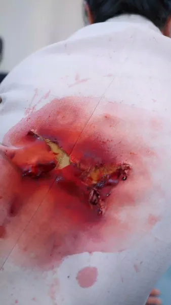 คฤหาสน์แค้น