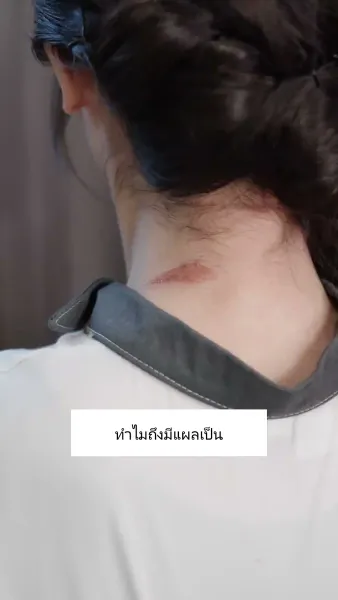 การกลับมาของคุณหนูผู้เป็นที่รัก