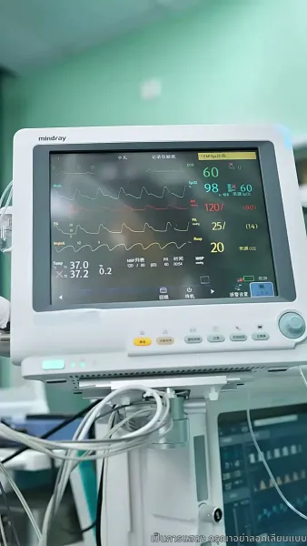 คำขอโทษที่สายไป