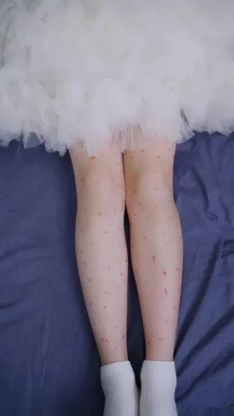 เจ้าตัวน้อย ละลายหัวใจเย็นชา