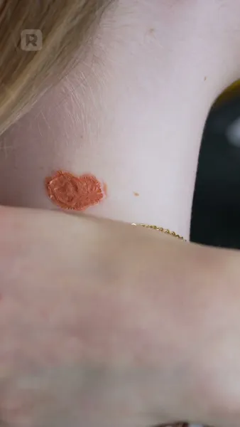 แก้วตาดวงใจในรอยลวง